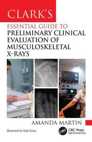 Clark's Essential Guide to Musculoskeletal X-ray Interpretation for Radiographers de Amanda Martin