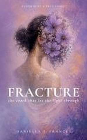 Fracture de Daniella J Frances