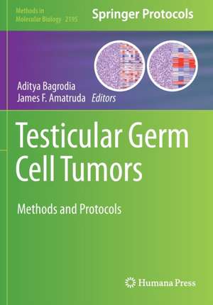 Testicular Germ Cell Tumors: Methods and Protocols de Aditya Bagrodia