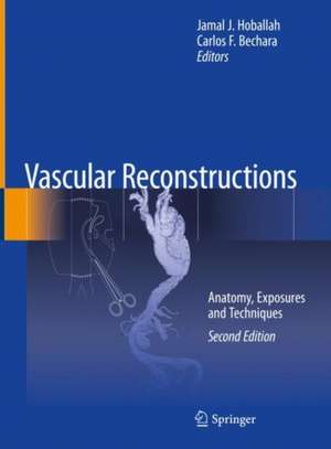 Vascular Reconstructions: Anatomy, Exposures and Techniques de Jamal J. Hoballah