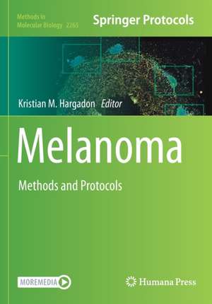 Melanoma: Methods and Protocols de Kristian M. Hargadon