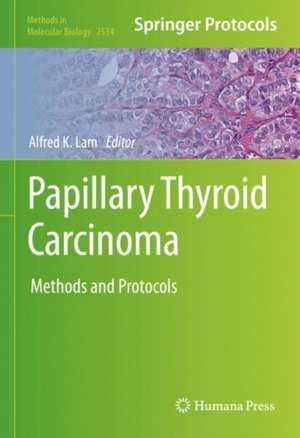 Papillary Thyroid Carcinoma: Methods and Protocols de Alfred K. Lam