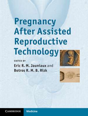 Pregnancy After Assisted Reproductive Technology de Eric Jauniaux