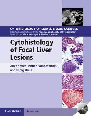 Cytohistology of Focal Liver Lesions de Aileen Wee