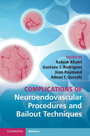 Complications of Neuroendovascular Procedures and Bailout Techniques de Rakesh Khatri