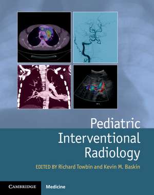 Pediatric Interventional Radiology de Richard Towbin