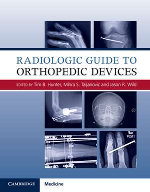 Radiologic Guide to Orthopedic Devices de Tim B. Hunter