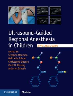 Ultrasound-Guided Regional Anesthesia in Children: A Practical Guide de Stephen Mannion