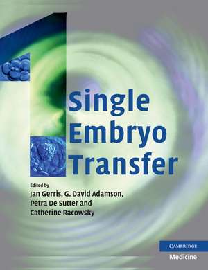 Single Embryo Transfer de Jan Gerris