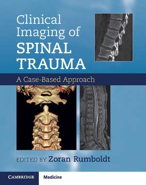 Clinical Imaging of Spinal Trauma: A Case-Based Approach de Zoran Rumboldt