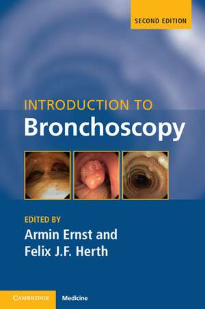 Introduction to Bronchoscopy de Armin Ernst