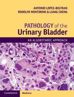 Pathology of the Urinary Bladder: An Algorithmic Approach de Antonio Lopez-Beltran