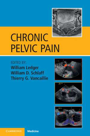 Chronic Pelvic Pain de William Ledger