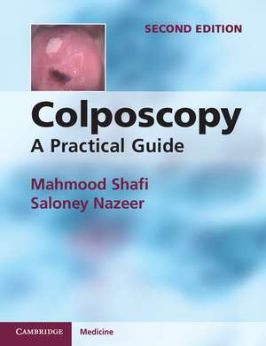 Colposcopy: A Practical Guide de Mahmood Shafi