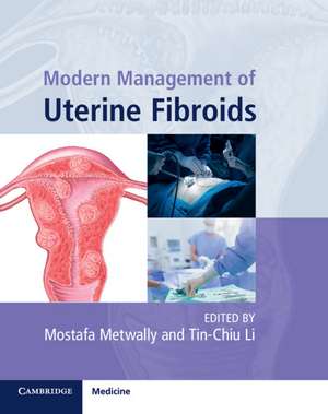 Modern Management of Uterine Fibroids de Mostafa Metwally