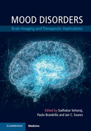 Mood Disorders: Brain Imaging and Therapeutic Implications de Sudhakar Selvaraj