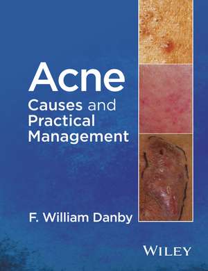 Acne de F William Danby