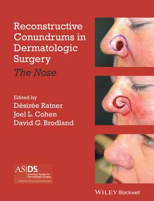 Reconstructive Conundrums in Dermatologic Surgery – The Nose de DS Ratner