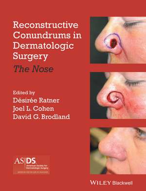 Reconstructive Conundrums in Dermatologic Surgery de Desiree S Ratner