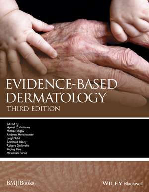 Evidence–Based Dermatology 3e de HC Williams