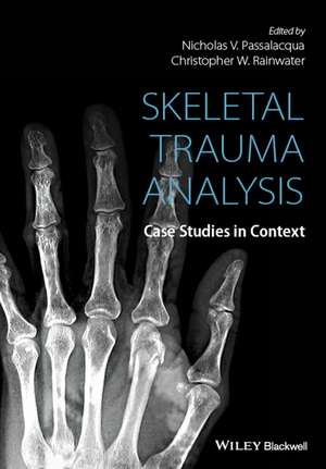 Skeletal Trauma Analysis de Nicholas V Passalacqua