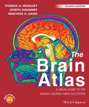 The Brain Atlas – A Visual Guide to the Human Central Nervous System 4e de TA Woolsey