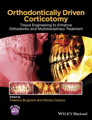 Orthodontically Driven Corticotomy – Tissue Engineering to Enhance Orthodontic and Multidisciplinary Treatment de F Brugnami