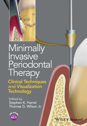 Minimally Invasive Periodontal Therapy – Clinical Techniques and Visualization Technology de SK Harrel