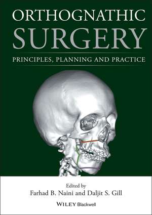 Orthognathic Surgery – Principles, Planning and Practice de F Naini