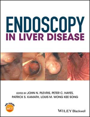 Endoscopy in Liver Disease de JN Plevris