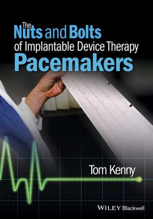 The Nuts and Bolts of Implantable Device Therapy – Pacemakers de T Kenny