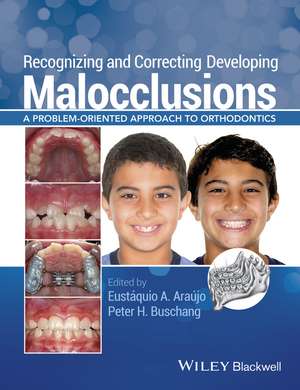 Recognizing and Correcting Developing Malocclusions – A Problem–Oriented Approach to Orthodontics de Eustáquio Afonso Araújo