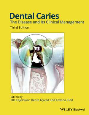 Dental Caries 3e de O Fejerskov