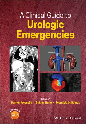 A Clinical Guide to Urologic Emergencies de H Wessells