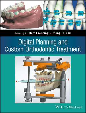 Digital Planning and Custom Orthodontic Treatment de KH Breuning