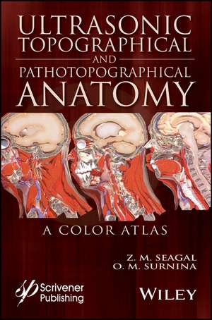 Ultrasonic Topographical and Pathotopographical Anatomy – A Color Atlas de ZM Seagal