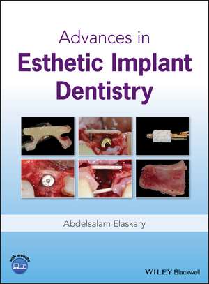 Advances in Esthetic Implant Dentistry de A Elaskary