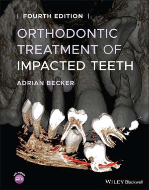 Orthodontic Treatment of Impacted Teeth 4th Edition de A. Becker