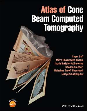 Atlas of Cone Beam Computed Tomography de Y Safi