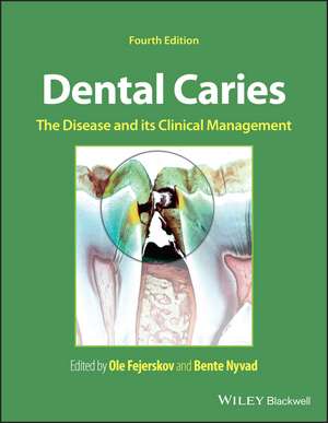 Dental Caries: The Disease and its Clinical Management de Ole Fejerskov