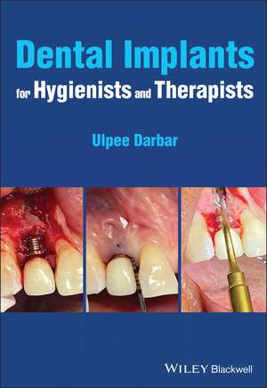 Dental Implants for Hygienists and Therapists de U Darbar