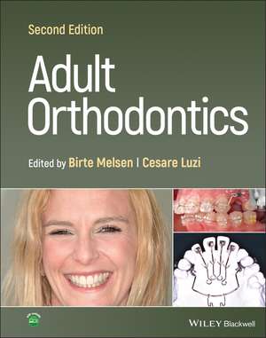 Adult Orthodontics 2nd Edition de B Melsen