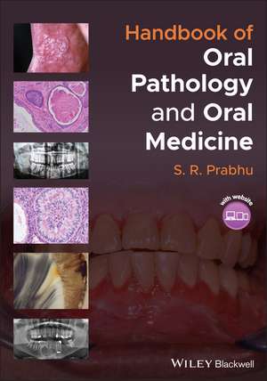 Handbook of Oral Pathology and Oral Medicine de SR Prabhu