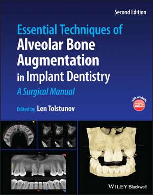 Essential Techniques of Alveolar Bone Augmentation in Implant Dentistry: A Surgical Manual de Len Tolstunov