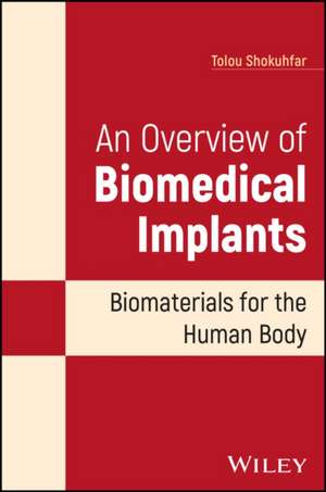 An Overview of Biomedical Implants: Biomaterials f or the Human Body de Shokuhfar