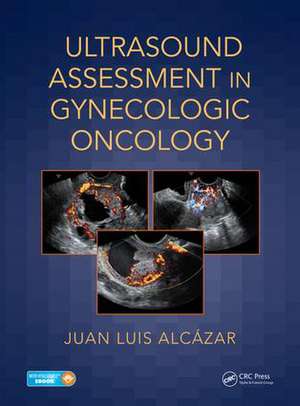 Ultrasound Assessment in Gynecologic Oncology de Juan Luis Alcázar