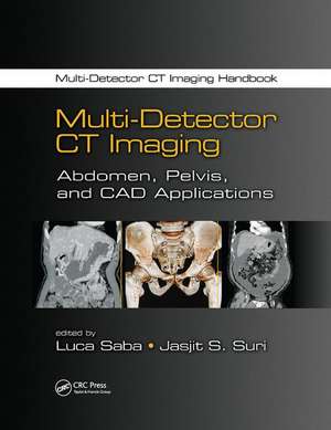 Multi-Detector CT Imaging: Abdomen, Pelvis, and CAD Applications de Luca Saba