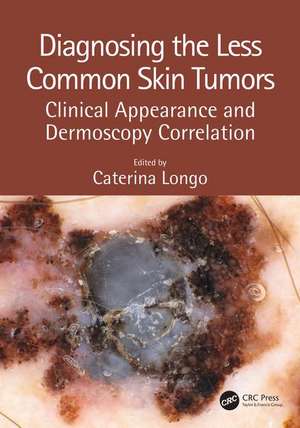 Diagnosing the Less Common Skin Tumors: Clinical Appearance and Dermoscopy Correlation de Caterina Longo