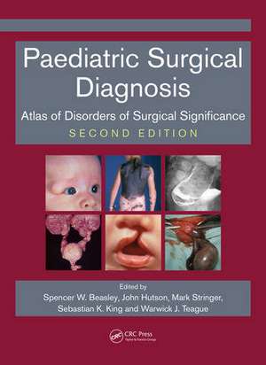 Paediatric Surgical Diagnosis: Atlas of Disorders of Surgical Significance, Second Edition de Spencer Beasley