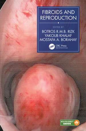 Fibroids and Reproduction de Botros R.M.B. Rizk